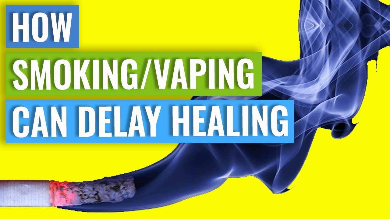 How Smoking & Vaping Can Delay Healing
