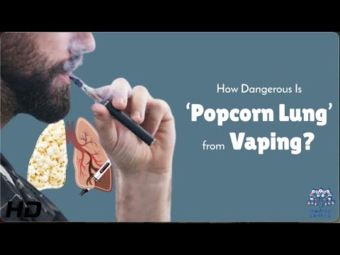 Is Vaping Giving You Popcorn Lung?